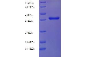 SDS-PAGE (SDS) image for Nuclear Import 7 Homolog (NIP7) (AA 1-180), (full length) protein (His-SUMO Tag) (ABIN5712007) (NIP7 Protein (AA 1-180, full length) (His-SUMO Tag))