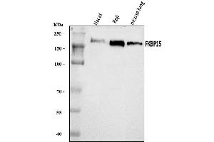 Western blot analysis of FKBP135/FKBP15 using anti-FKBP135/FKBP15 antibody (ABIN7600397). (FKBP15 Antikörper  (AA 19-1210))