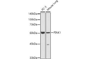 Western blot analysis of extracts of various cell lines, using PINK1 antibody (ABIN6128458, ABIN6145666, ABIN6145668 and ABIN6222945) at 1:500 dilution. (PINK1 Antikörper  (AA 282-581))
