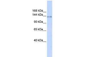 WB Suggested Anti-SUPT16H Antibody Titration:  0. (SUPT16H Antikörper  (Middle Region))