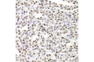 Immunohistochemistry of paraffin-embedded rat kidney using SOX5 antibody. (SOX5 Antikörper  (AA 1-120))