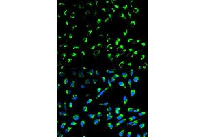 Immunofluorescence analysis of MCF-7 cells using SFN antibody. (14-3-3 sigma/SFN Antikörper  (AA 1-248))