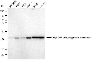 Western blotting analysis using Acyl-CoA dehydrogenase short chain antibody (ABIN7797493). (Rekombinanter Acyl Co-A Dehydrogenase (AIDB) (chain short) Antikörper)