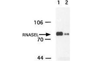 Western blot analysis of RNASEL in insect cell extracts transfected with recombinant human RNASEL using RNASEL monoclonal antibody, clone 2E9 .