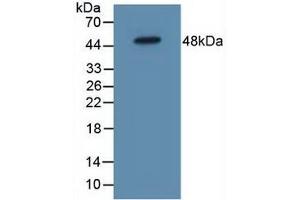 Figure. (IL5RA Antikörper  (AA 42-182))