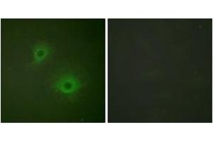 Immunofluorescence analysis of HuvEc cells, using EPHB1/2 (Ab-594/604) Antibody. (EPHB1/2 Antikörper  (AA 561-610))
