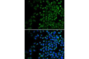 Immunofluorescence analysis of HeLa cells using BAK1 antibody.