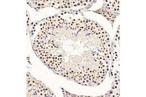 Immunohistochemistry of paraffin embedded mouse testis using CHD1L (ABIN7073491) at dilution of 1:650 (300x lens) (CHD1L Antikörper)