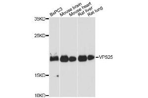 Western blot analysis of extracts of various cell lines, using VPS25 antibody. (VPS25 Antikörper)