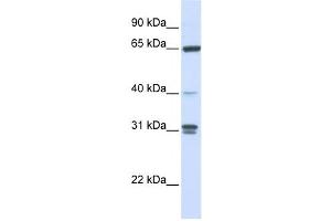 Western Blotting (WB) image for anti-Guanylate Binding Protein 2, Interferon-Inducible (GBP2) antibody (ABIN2459799) (GBP2 Antikörper)