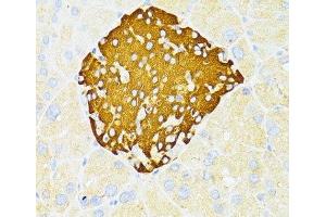 Immunohistochemistry of paraffin-embedded Mouse pancreatic islets using DDIT3 / CHOP Polyclonal Antibody at dilution of 1:100 (40x lens). (DDIT3 Antikörper)