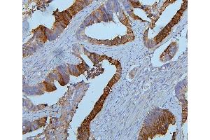 IHC analysis of PYROXD1 using anti-PYROXD1 antibody (ABIN6719650). (PYROXD1 Antikörper  (AA 48-230))