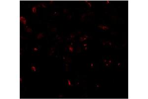 Immunofluorescence of TFEB in human lung tissue with TFEB antibody at 20 μg/mwith TFEB antibody at 2 µg/ml (TFEB Antikörper  (N-Term))