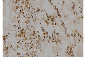 ABIN6268885 at 1/100 staining Human lung tissue by IHC-P. (HSPH1 Antikörper  (C-Term))