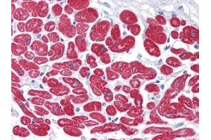 Immunohistochemical analysis of paraffin-embedded human Heart tissues using MYL3 antibody. (MYL3/CMLC1 Antikörper)