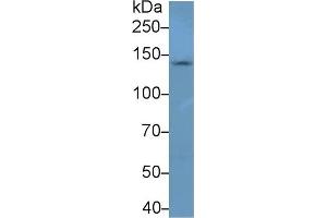 Detection of NEF3 in Mouse Cerebrum lysate using Polyclonal Antibody to Neurofilament 3 (NEF3) (NEFM Antikörper  (AA 105-287))