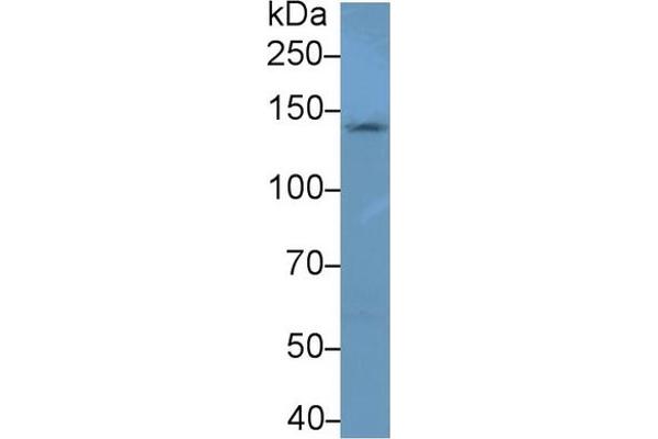 NEFM Antikörper  (AA 105-287)