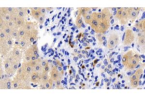 Detection of CASP1 in Human Liver Tissue using Polyclonal Antibody to Caspase 1 (CASP1) (Caspase 1 Antikörper  (AA 120-297))