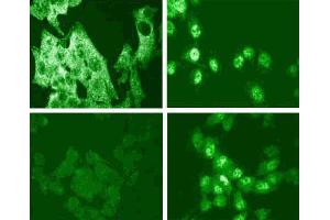 Immunofluorescence staining for p38 MAPK (pT180/pY182) (right figure). (MAPK14 Antikörper  (pThr180))