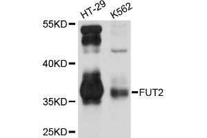 Western blot analysis of extracts of various cell lines, using FUT2 antibody. (FUT2 Antikörper)