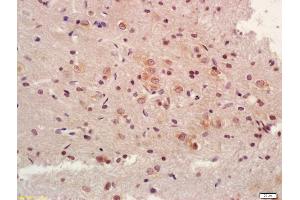 Formalin-fixed and paraffin embedded rat brain labeled with Anti-NDUFV1 Polyclonal Antibody, Unconjugated (ABIN751738) at 1:200 followed by conjugation to the secondary antibody and DAB staining (NDUFV1 Antikörper  (AA 41-140))