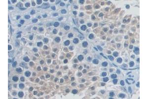 DAB staining on IHC-P; Samples: Mouse Testis Tissue (TNFRSF11A Antikörper  (AA 359-542))