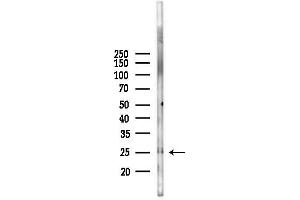 Western blot analysis of lysates from Mouse liver, using PTP4 Antibody at 1/1000 dilution.