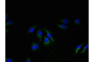 Immunofluorescent analysis of A549 cells using ABIN7161422 at dilution of 1:100 and Alexa Fluor 488-congugated AffiniPure Goat Anti-Rabbit IgG(H+L) (NPBWR2 Antikörper  (AA 1-45))