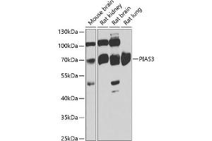Western blot analysis of extracts of various cell lines, using PI antibody (ABIN6128452, ABIN6145599, ABIN6145601 and ABIN6222851) at 1:1000 dilution. (PIAS3 Antikörper  (AA 452-628))