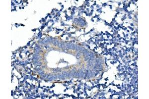 IHC analysis of SYP using anti-SYP antibody (ABIN7603120). (Synaptophysin Antikörper  (N-Term))