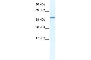Annexin A7 antibody used at 2. (Annexin VII Antikörper  (N-Term))