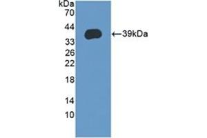Detection of Recombinant LEAP2, Human using Polyclonal Antibody to Liver Expressed Antimicrobial Peptide 2 (LEAP2) (LEAP2 Antikörper  (AA 23-76))