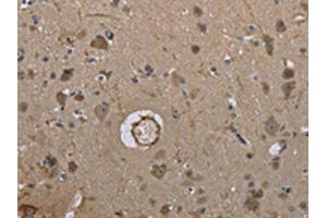 The image on the left is immunohistochemistry of paraffin-embedded Human brain tissue using ABIN7191406(MARK4 Antibody) at dilution 1/40, on the right is treated with synthetic peptide. (MARK4 Antikörper)