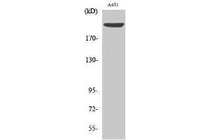 Western Blotting (WB) image for anti-Extra Spindle Poles Like 1 (ESPL1) (pSer801) antibody (ABIN3182749) (Separase Antikörper  (pSer801))