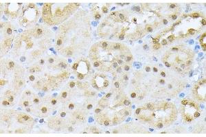 Immunohistochemistry of paraffin-embedded Mouse kidney using CSNK2A1 Polyclonal Antibody at dilution of 1:100 (40x lens). (CSNK2A1/CK II alpha Antikörper)