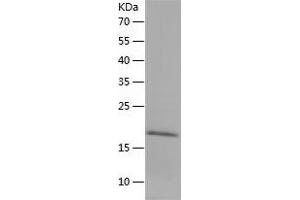 IL1RN Protein (AA 25-178) (His tag)