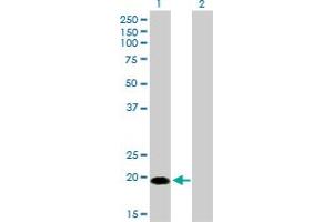 Western Blot analysis of CETN1 expression in transfected 293T cell line by CETN1 monoclonal antibody (M01), clone 2A6. (Centrin 1 Antikörper  (AA 1-100))