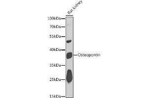 Western blot analysis of extracts of Rat kidney, using Osteopontin antibody (ABIN6132294, ABIN6148378, ABIN6148380 and ABIN6218573) at 1:1000 dilution. (Osteopontin Antikörper  (AA 106-205))
