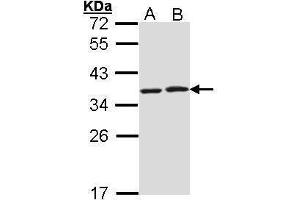 Western Blotting (WB) image for anti-HCLS1 Associated Protein X-1 (HAX1) antibody (ABIN2855251)