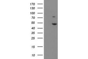 Western Blotting (WB) image for anti-Eukaryotic Translation Initiation Factor 2B, Subunit 3 Gamma, 58kDa (EIF2B3) antibody (ABIN1497969) (EIF2B3 Antikörper)