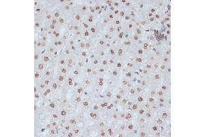 Immunohistochemistry of paraffin-embedded rat liver using Phospho-CDK1-Y15 antibody (ABIN3019442, ABIN3019443, ABIN3019444 and ABIN6225371) at dilution of 1:100 (40x lens). (CDK1 Antikörper  (pTyr15))