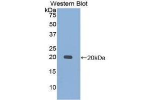 Western blot analysis of the recombinant protein. (Calmodulin 1 Antikörper  (AA 2-149))