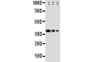 Lane 3: Recombinant Human GATA2 Protein 2. (GATA2 Antikörper  (N-Term))