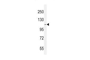 AT8B2 Antibody (N-term) (ABIN654734 and ABIN2844422) western blot analysis in CEM cell line lysates (35 μg/lane). (ATP8B2 Antikörper  (N-Term))