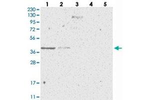 Western blot analysis of Lane 1: RT-4, Lane 2: U-251 MG, Lane 3: Human Plasma, Lane 4: Liver, Lane 5: Tonsil with SLC35A5 polyclonal antibody . (SLC35A5 Antikörper)