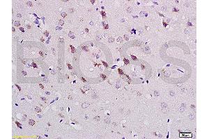 Formalin-fixed and paraffin embedded rat brain tissue labeled with Anti-CaMK2a Polyclonal Antibody (ABIN670176), Unconjugatedat 1:200, followed by conjugation to the secondary antibody and DAB staining (CAMK2A Antikörper  (AA 401-478))