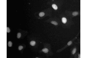 Immunofluorescent staining of A549 (ATCC CCL-185) cells. (Retinoblastoma 1 Antikörper  (AA 332-344))