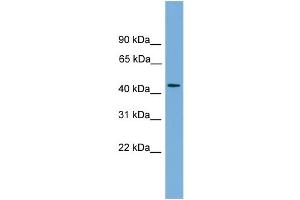 WB Suggested Anti-ZNF620 Antibody Titration: 0. (ZNF620 Antikörper  (N-Term))