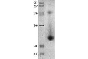 Validation with Western Blot (SOD1 Protein (His tag))