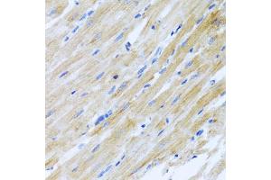 Immunohistochemistry of paraffin-embedded rat heart using CCL17 antibody (ABIN5971483) at dilution of 1/100 (40x lens). (CCL17 Antikörper)